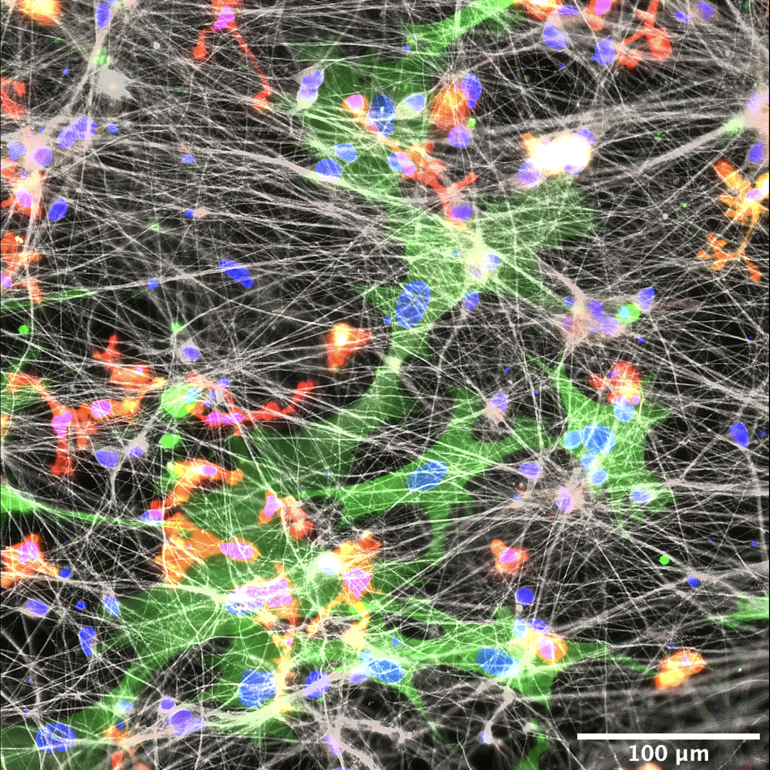 Close-up imaging of a web of multicolored neural connections, showing a measurement scale of about 400 micrometers across in its entirety.